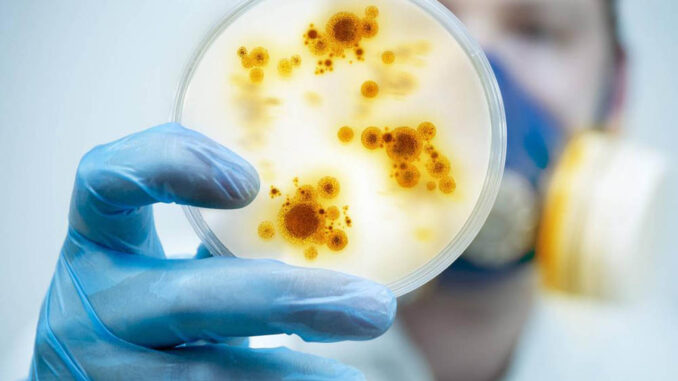 meningitis bacteriana