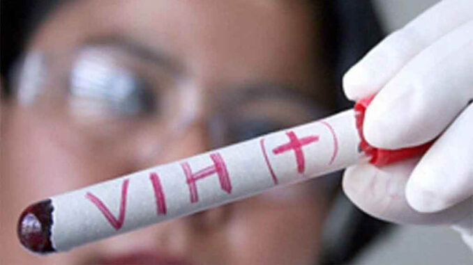 Brasil-variante-VIH-1